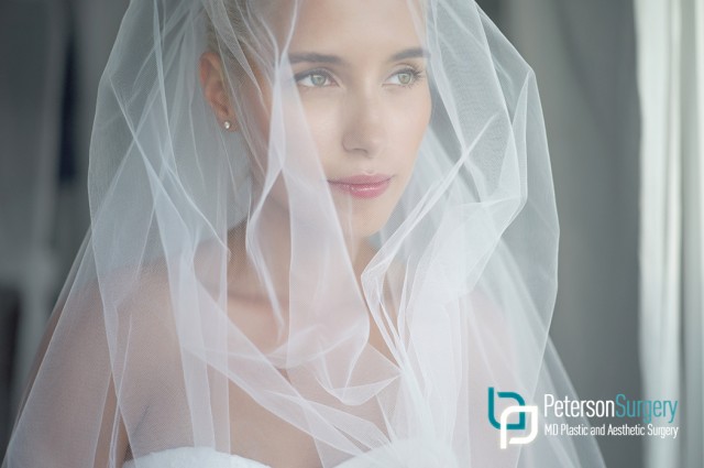 Brides-to-Be are Saying 'I Do' to Plastic Surgery