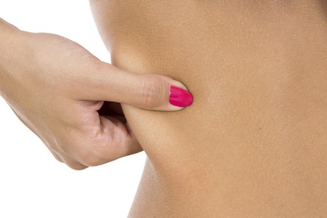 Top 5 Reasons Why You Should Have a Tummy Tuck