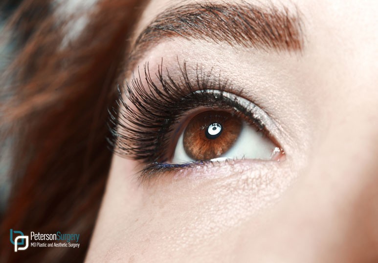 Skin Rejuvenation Blog Series Part 1: Eye Area