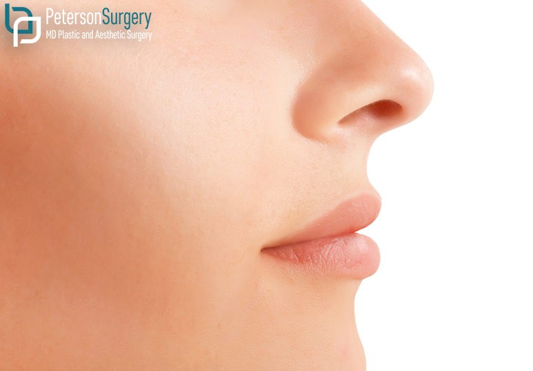 Dr. Brian Peterson Kelowna Plastic Surgeon 4 Types of Nasal Surgery