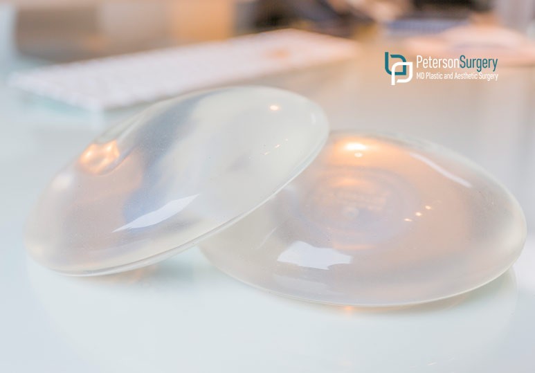 Peterson MD Should You Have Your Breast Implants Removed?