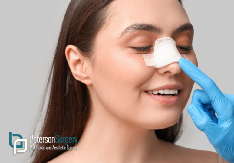 Achieve Balance and Symmetry with Nasal Surgery in Kelowna 