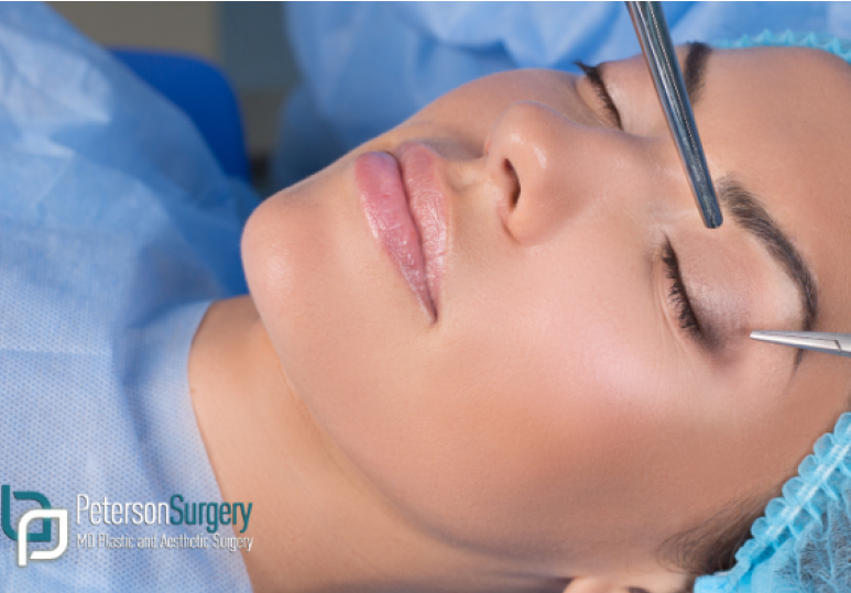 What to Know About Eyelid Surgery: Benefits of Blepharoplasty 