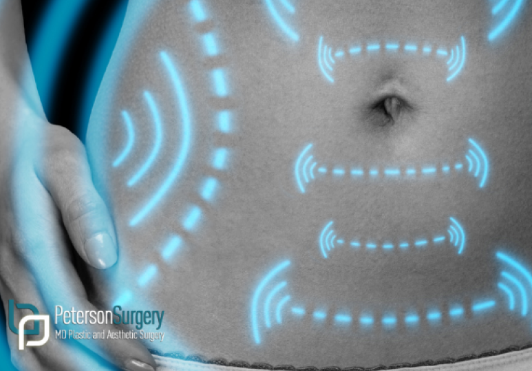 Understanding Liposuction: Contour, Combine, and Transform