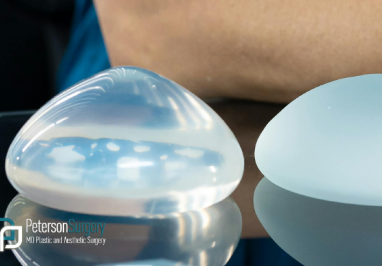 Breast Augmentation Trends Natural-Looking Results and What’s New 