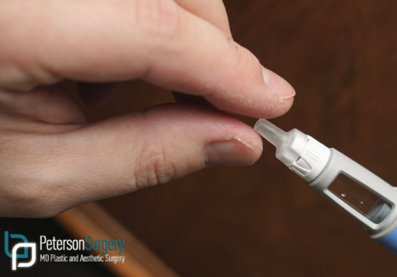 Post-Ozempic Confidence: How Surgery Can Refine Weight Loss Changes