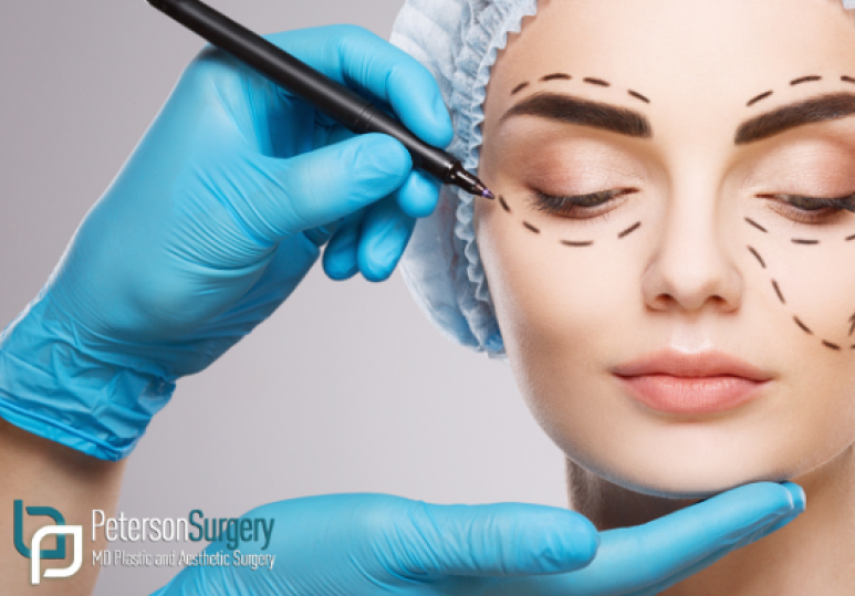 How to Choose the Right Plastic Surgeon in Calgary: 5 Key Tips How to Choose the Right Plastic Surgeon in Calgary: 5 Key Tips