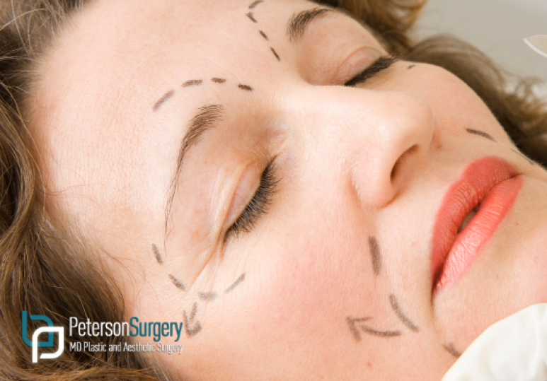 Facial Rejuvenation in Winter: Why It’s the Ideal Season for Surgery