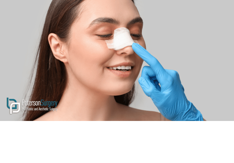 Nose Job vs Rhinoplasty vs Nasal Surgery: What’s the Difference? Nose Job vs Rhinoplasty vs Nasal Surgery: What’s the Difference?