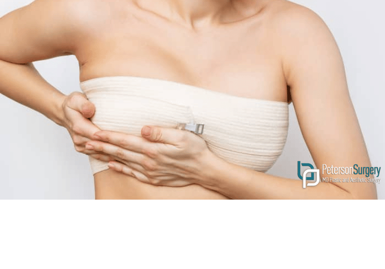 Headline: Breast Reduction Recovery Timeline: What to Expect After Surgery Headline: Breast Reduction Recovery Timeline: What to Expect After Surgery