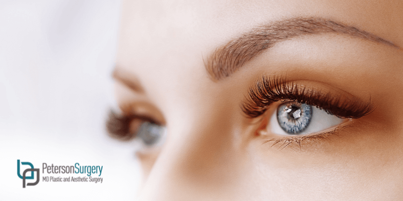 What To Expect After Brow Lift Surgery