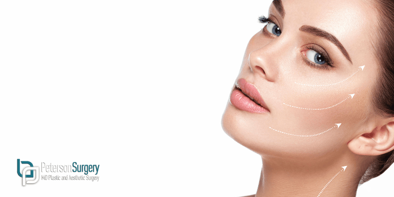 Questions To Ask When Considering A Facelift