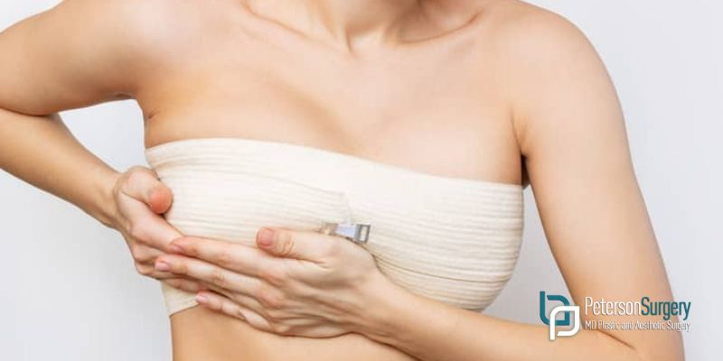 8 Tips For A Better Recovery After Breast Lift Surgery