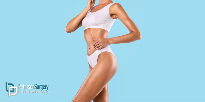 Targeted Liposuction: Sculpting Your Dream Body