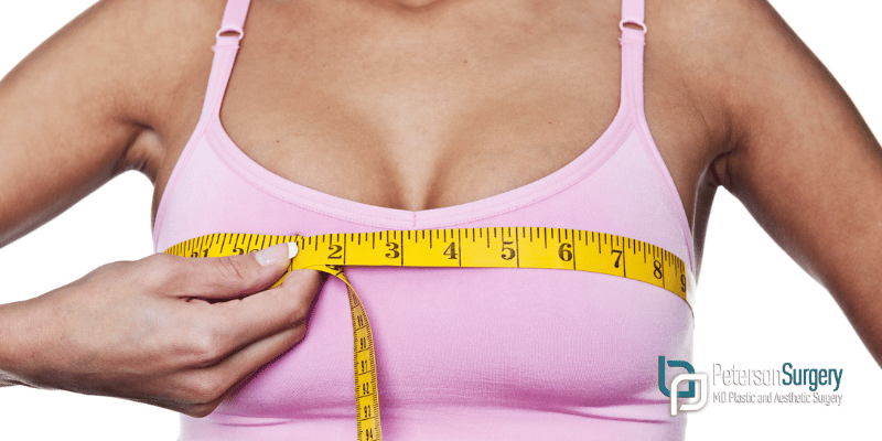 Empowerment and Self-Confidence: The Psychological Impact of Breast Reduction