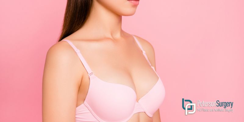 Combining Breast Lift and Reduction for Optimal Outcomes