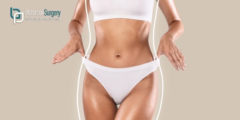 Top 5 Reasons Kelowna Residents Choose Liposuction for Body Contouring