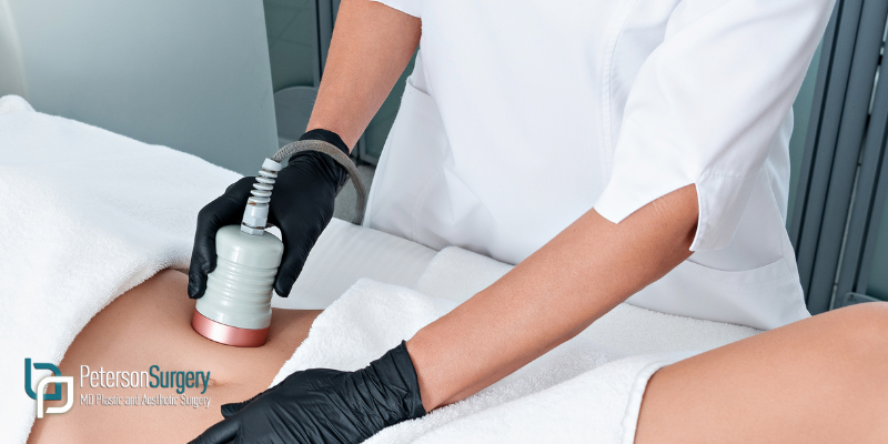 Achieve Your Dream Shape with Body Contouring in Kelowna 