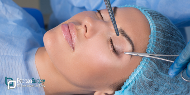 What to Know About Eyelid Surgery: Benefits of Blepharoplasty 