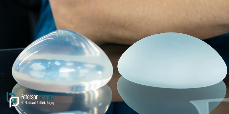 Breast Augmentation Trends Natural-Looking Results and What’s New 