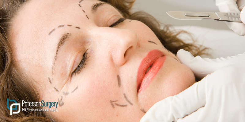 Facial Rejuvenation in Winter: Why It’s the Ideal Season for Surgery