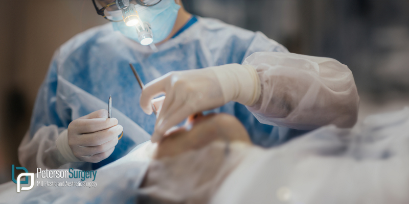 How Long Does Plastic Surgery Take to Heal: What Patients Can Expect