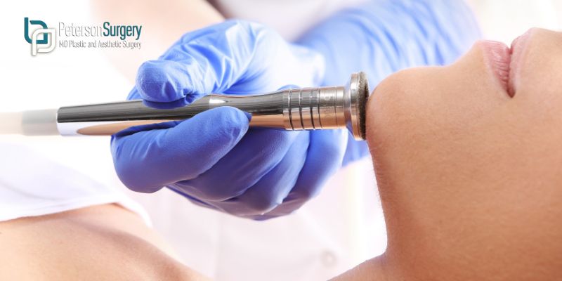 WHAT IS DERMABRASION AND HOW DOES IT IMPROVE SKIN TEXTURE? - KELOWNA DERMABRASION