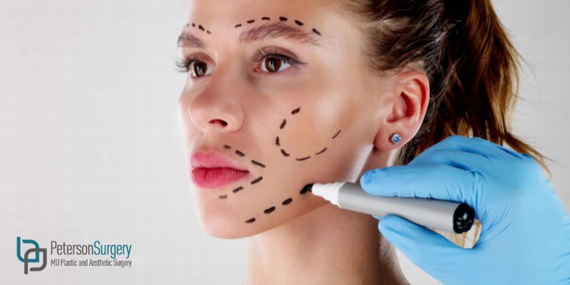 POPULAR COSMETIC PROCEDURES PATIENTS ARE REQUESTING IN 2026 - KELOWNA PLASTIC SURGEON